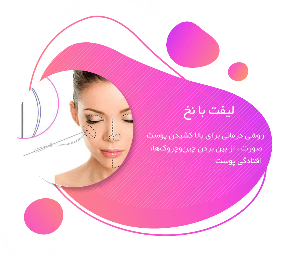 لیفت صورت با نخ