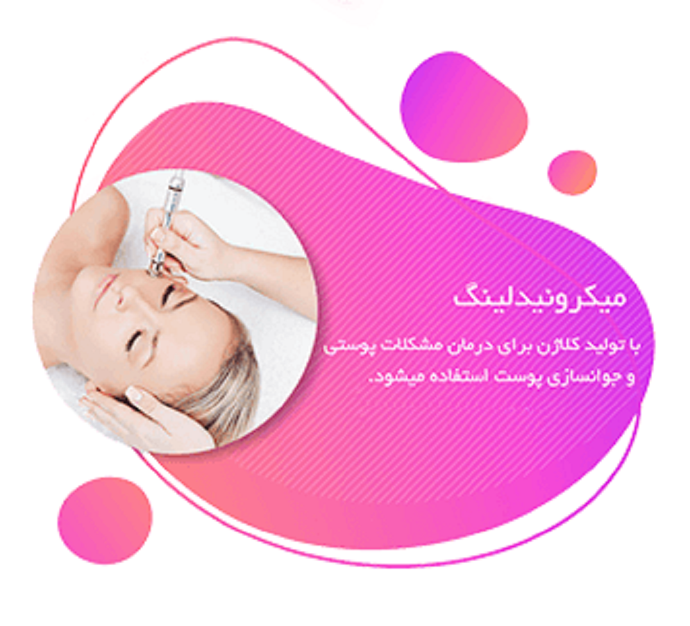 میکرونیدلینگ